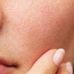 Florence-Drean-Naturopathe-Saint-genis-laval-Visage-peau